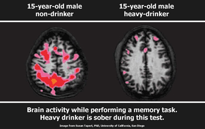 Alcohol has severe adverse effects on the brain. Before you reach for your next tipple, you should read this.